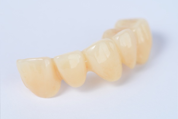 Understanding The Process For Dental Bridges