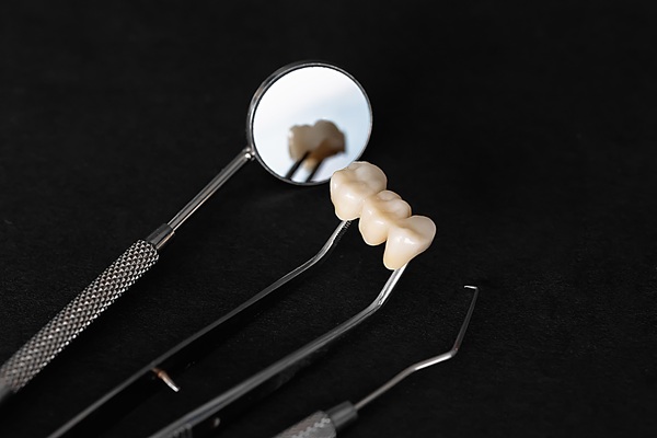 Why Dental Bridges Are An Effective Tooth Restoration