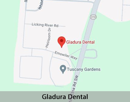 Map image for Will I Need a Bone Graft for Dental Implants in Pataskala, OH