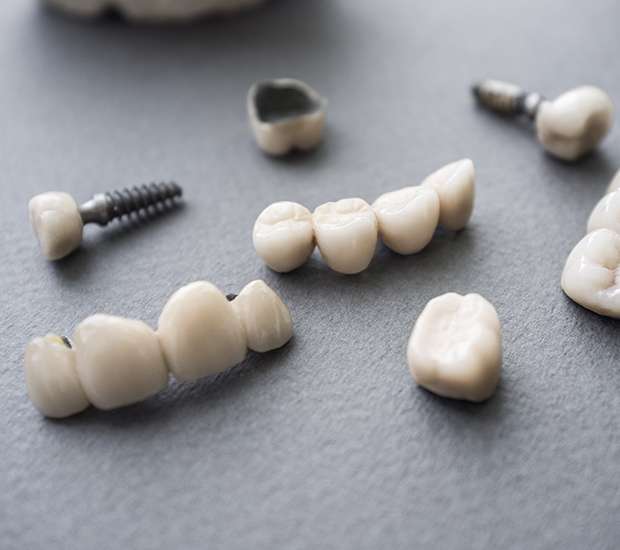 Pataskala The Difference Between Dental Implants and Mini Dental Implants