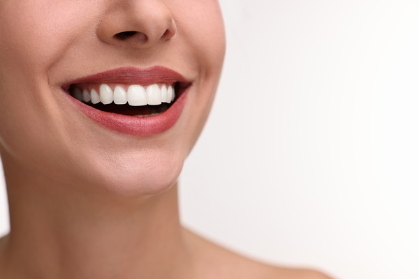 Smile Makeover: What Are The Cosmetic Benefits Of Dental Crowns?